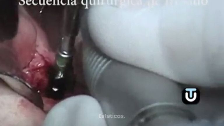 Logra acabar con los problemas en tu dentadura