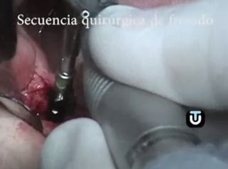 Logra acabar con los problemas en tu dentadura