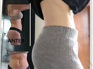 Lipoescultura HD - Dra. Paula Granero