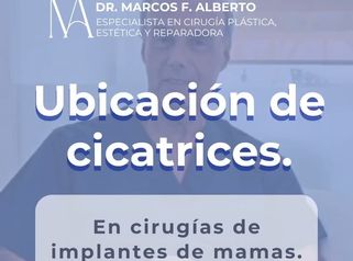 Cicatrices en un aumento de mamas - Dr. Marcos F. Alberto