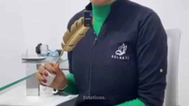 Hifu resultado - Dra. Haylen Solarte