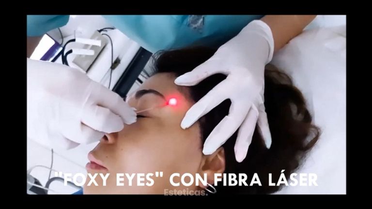 Foxy eyes - Rieck Klinik Medical Spa