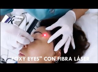 Foxy eyes - Rieck Klinik Medical Spa