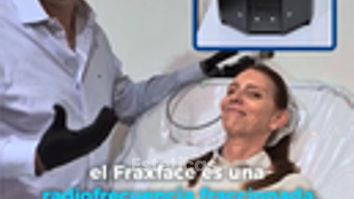 Fraxface Radiofrecuencia facial -Dr. Damián Wengrowicz
