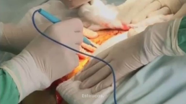 Consigue el abdomen que siempre soñaste