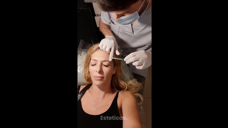 Toxina botulínica - Dr. Martín Salas