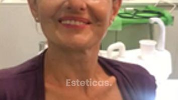 Testimonial - Implantes Dentales