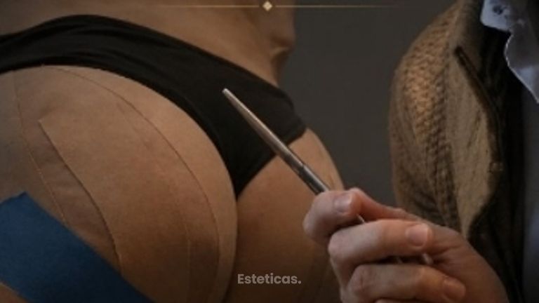 Aumento de glúteos