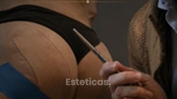 Aumento de glúteos