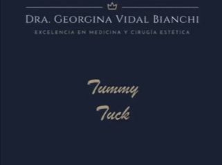 Abdominoplastia - Tummy Tuck