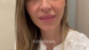 Blefaroplastia - Dra. María Victoria Rodríguez