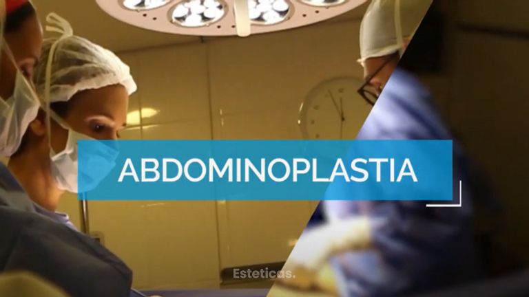 Abdominoplastia - Dr. Mateo Castro Béduchaud
