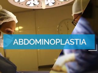 Abdominoplastia - Dr. Mateo Castro Béduchaud