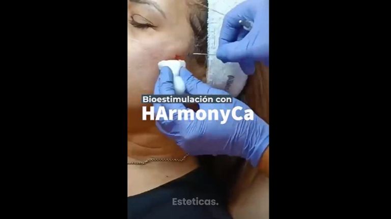 HArmonyCa - Dra. Torrijos Noelia