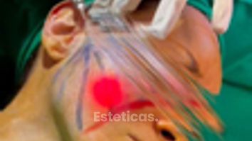 Endoláser - Dr. Rodolfo Villavicencio
