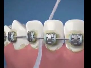 Ortodoncia - Dental Advance