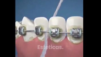 Ortodoncia - Dental Advance