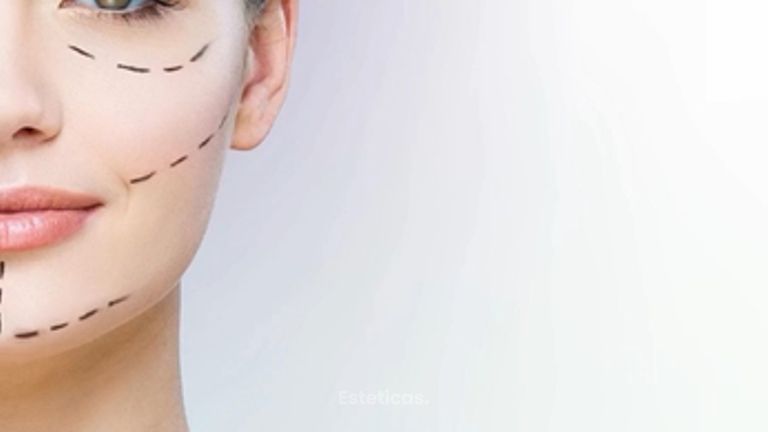 i-ThreadInnovación - Innovación - Rejuvencimiento Facial - Dra. Jimena Frasso