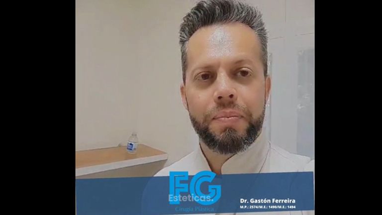 Radiesse - Dr. Gastón Eduardo Ferreira