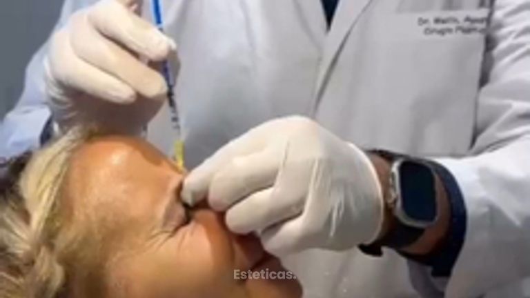 Botox - Dr. Agustín Matia