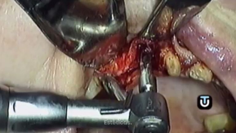 Tu mejor opción dental