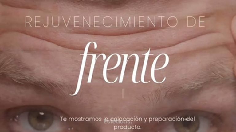 Rejuvenecimiento de Frente - Dra. Jimena Frasso