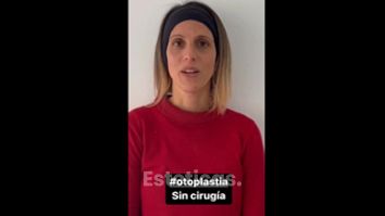 Otoplastia sin cirugía - Dra. María de la Paz Vélez