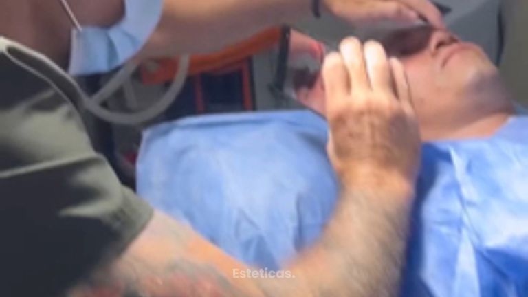 Rinoplastía - Dr. Juan Pablo Oliver