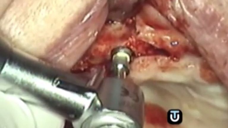 Consigue la mejor dentadura