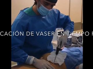 Lipo Vaser - Dr Damián Galeazzo y Equipo