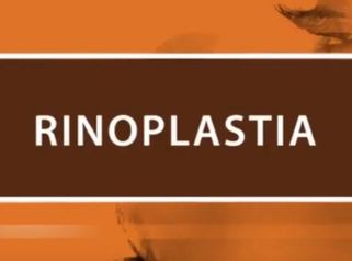 Rinoplastía