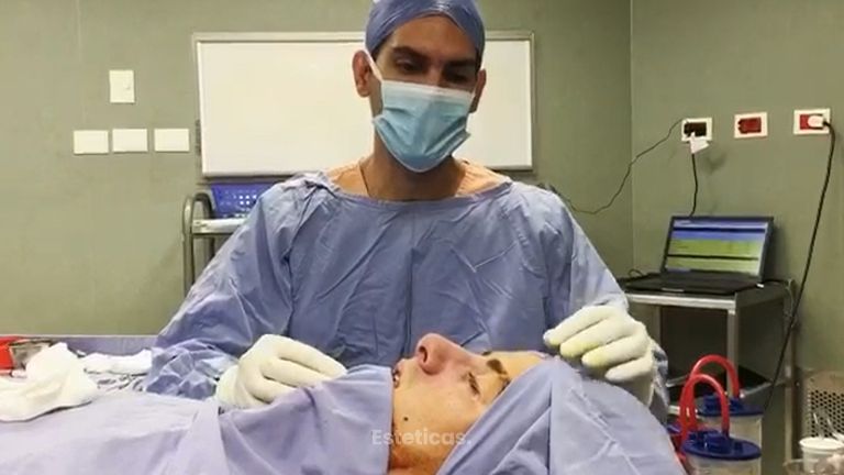 Rinoplastia