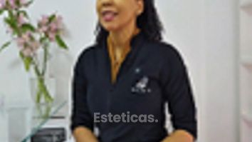 Rinomodelación antes y despues - Dra. Haylen Solarte