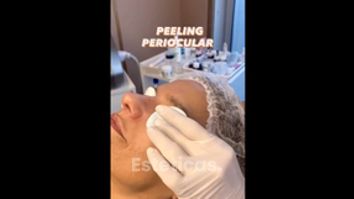 Peeling - Esteticiens 