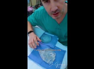 Protesis mamarias - Dr. Damián Galeazzo y Equipo