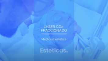 Láser CO2 Fraccionado - Dr. Mateo Castro Béduchaud