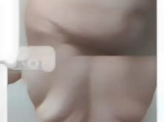 Abdominoplastia - Dr. Matias Llabres