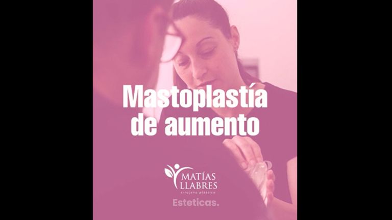 Aumento mamas - Dr. Matías Llabres