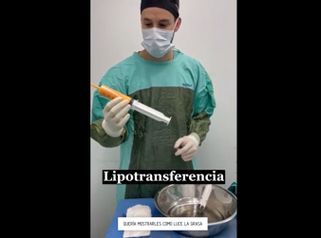 Lipotransferencia - Dr. Santiago Rosales Castiglione