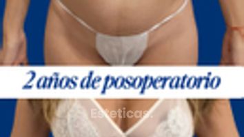 Dermolipectomia - Dr. Damián Wengrowicz