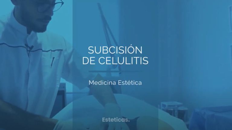 Tratamiento eficaz para la CELULITIS - Dr. Mateo Castro Béduchaud