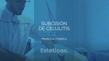 Tratamiento eficaz para la CELULITIS - Dr. Mateo Castro Béduchaud