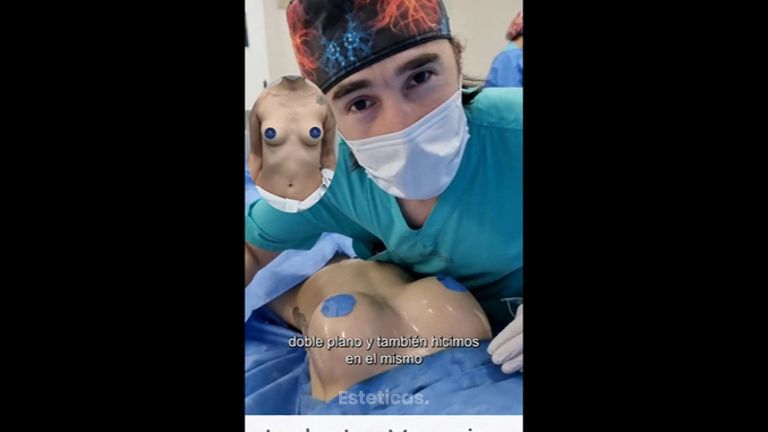 Aumento mamas - Dr. Damián Galeazzo y Equipo