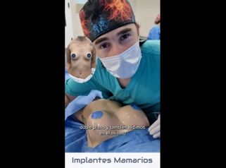 Aumento mamas - Dr. Damián Galeazzo y Equipo