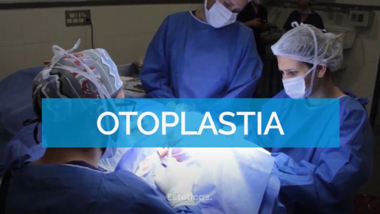 Otoplastia - Dr. Mateo Castro Béduchaud