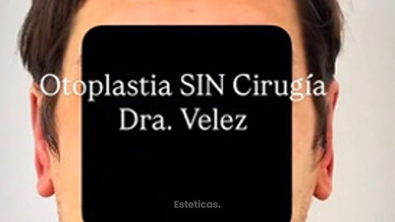 Otoplastia Sin cirugía  - Dra. María de la Paz Vélez