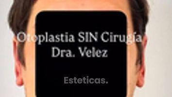Otoplastia Sin cirugía  - Dra. María de la Paz Vélez