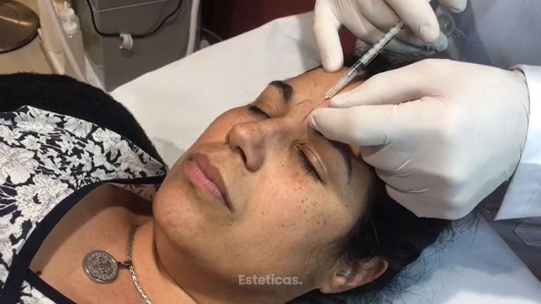 Botox - Dr. Víctor Armesto