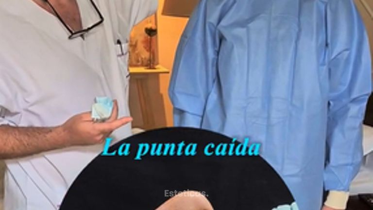 Rinoplastia - Dr. Damián Wengrowicz