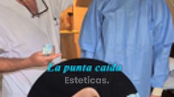 Rinoplastia - Dr. Damián Wengrowicz
